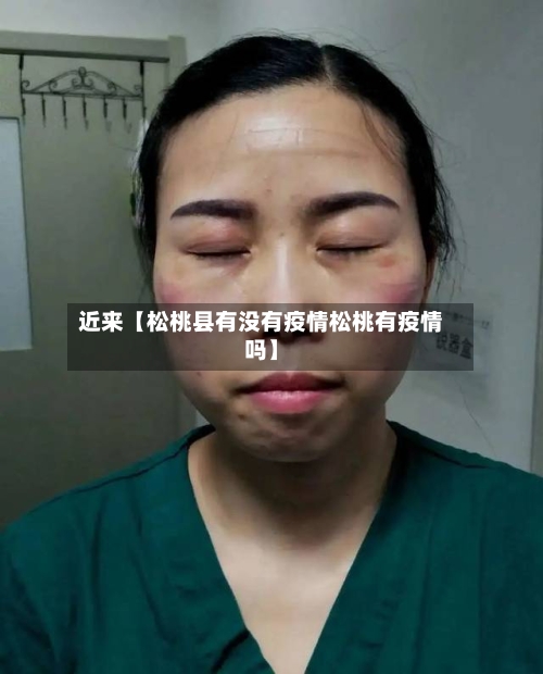 近来【松桃县有没有疫情松桃有疫情吗】-第3张图片